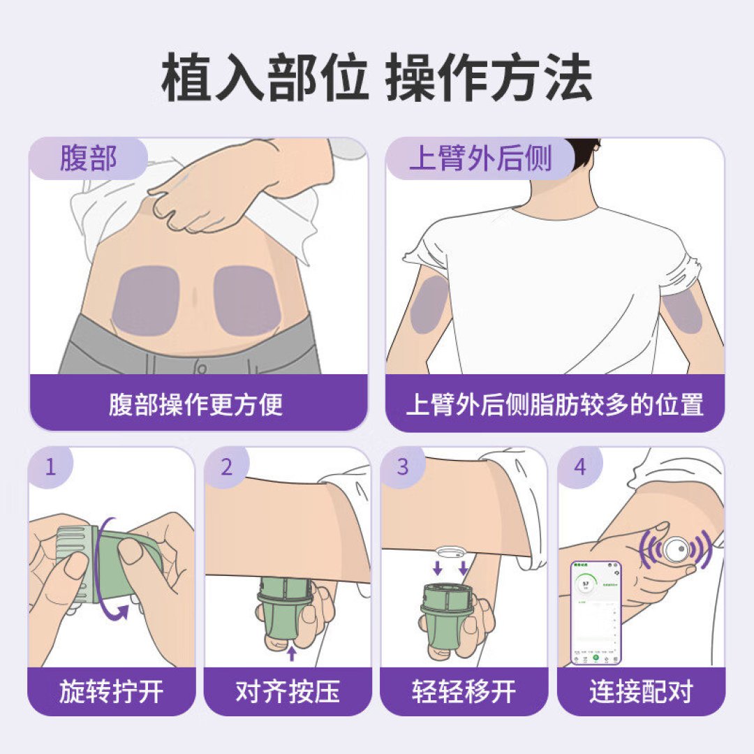 最低70元一个，还能走医保报销：长期戴动态血糖仪的4条省钱路线和3个坑