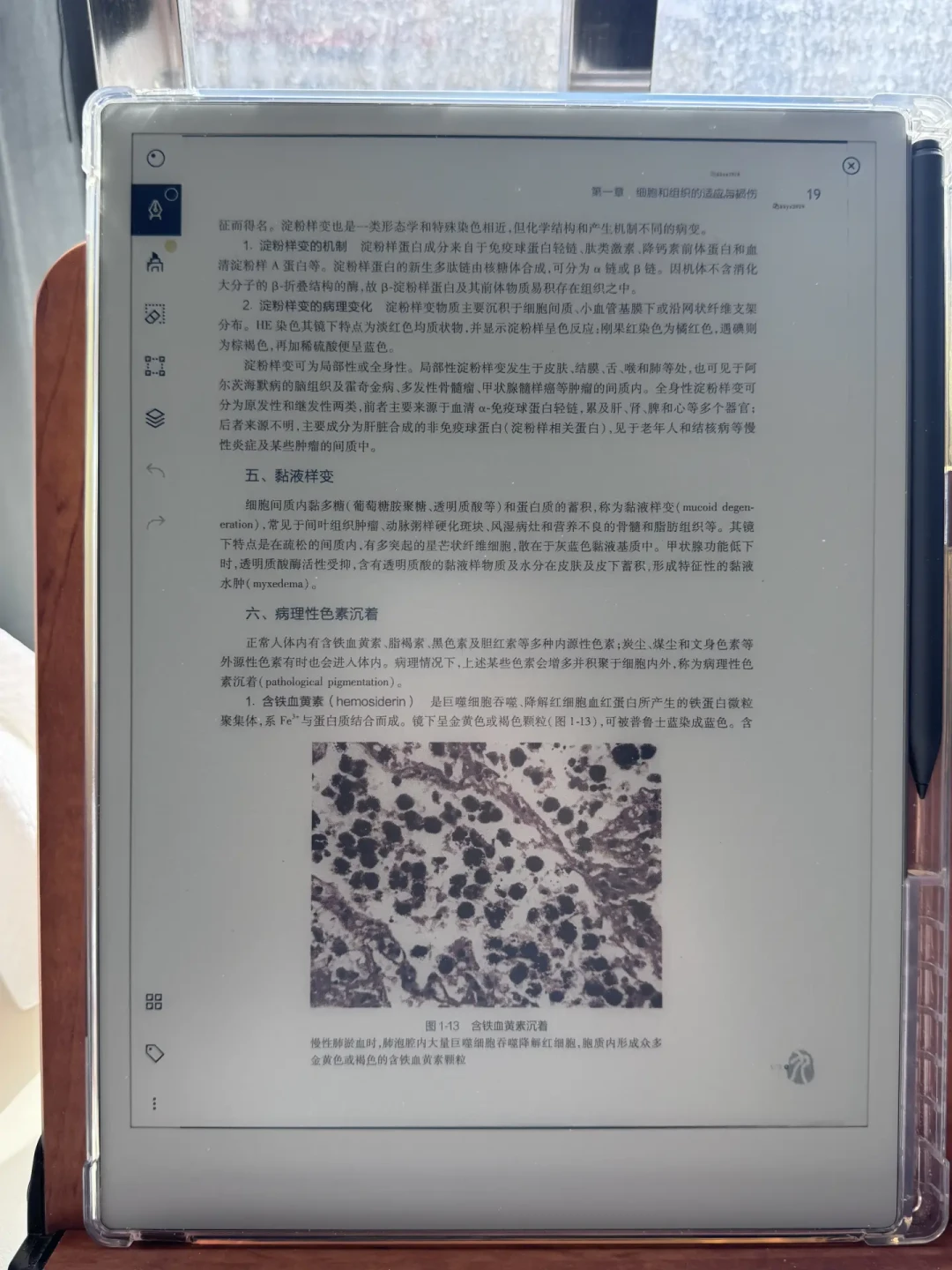 坏点被说是“正常”、过保换新要花1700元:2026年买reMarkable,先选售后再选机型