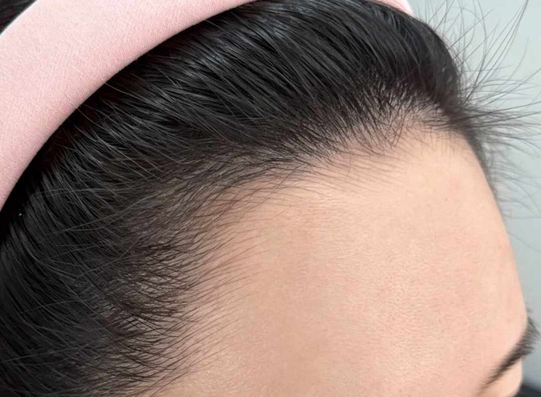 秋天掉发变多,先别急着下单防脱:3步自测要不要紧,这3笔钱建议别花