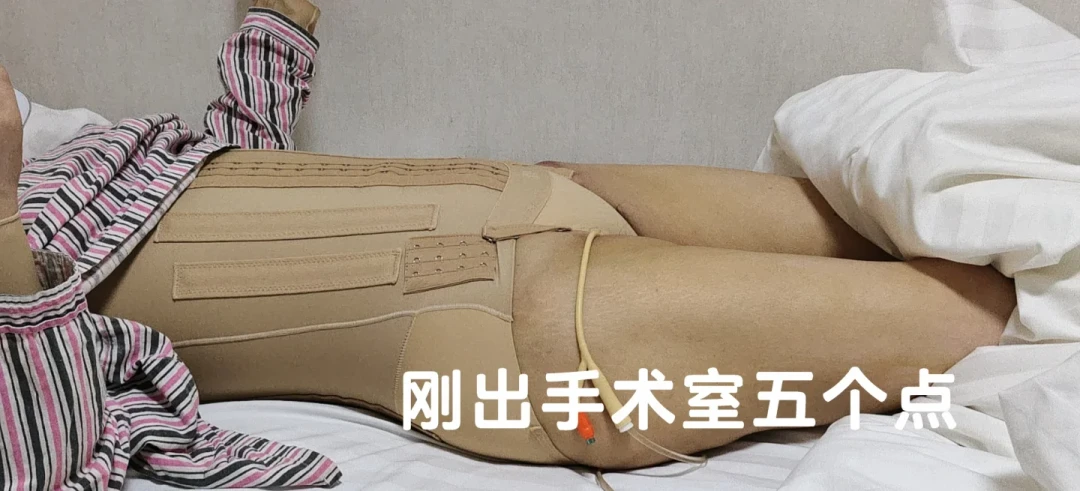 7万元吸脂吸出“波浪背”:几百篇失败帖复盘出的避坑清单
