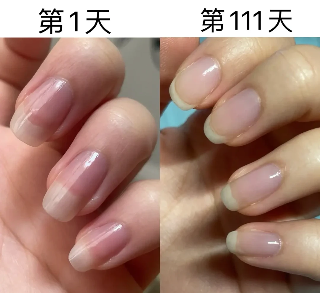 同一瓶OPI T80:有人养出游离线,有人4天空甲,差的到底是不是这瓶油?