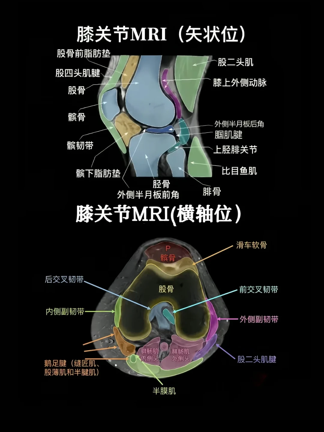 41岁白领练瑜伽,双膝半月板三度撕裂上热搜:瑜伽不坏,但这几种练法真的毁膝盖