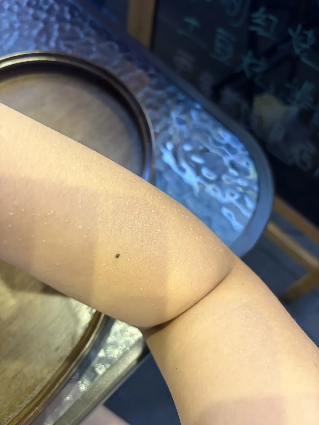 军训晒伤,脸又红又烫还起皮起泡?先别急着下单“晒后修护神器”:我把三个平台的偏方、软广和皮肤科医生说法对完了,真正有用的就这几步