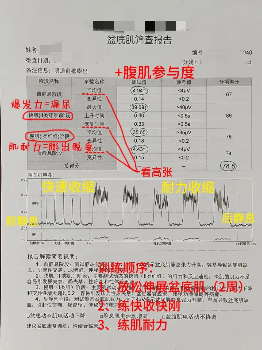 17万收藏的凯格尔跟练下面,有人说