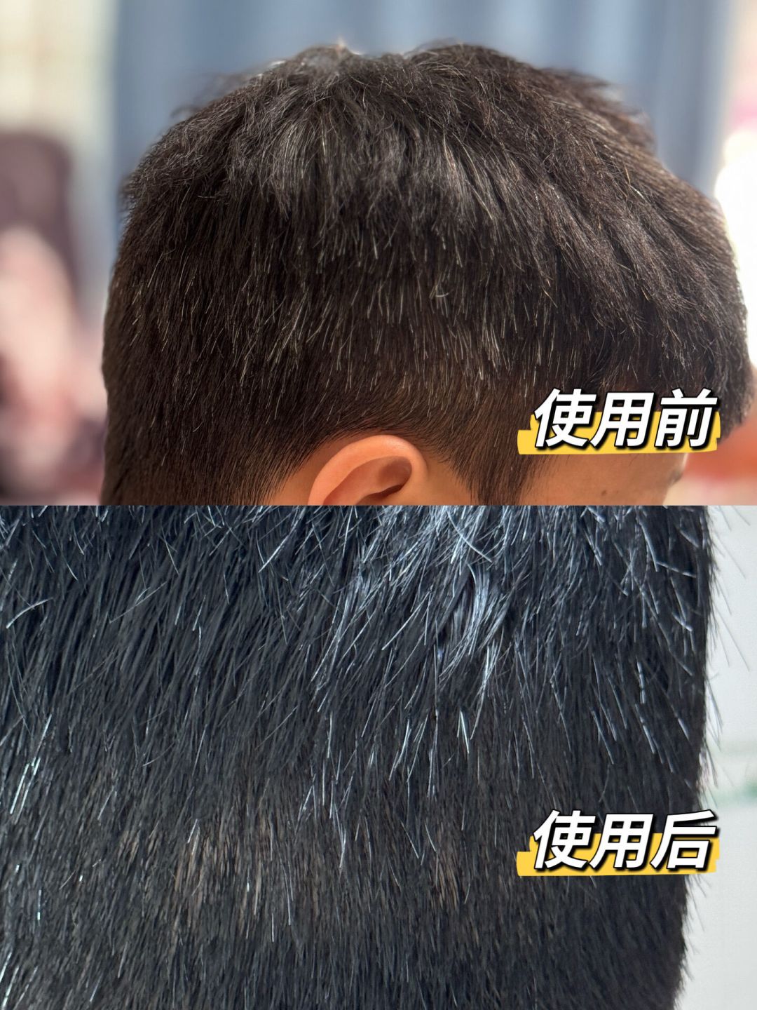 白发根两周就冒头：5种遮白发方案，我把一年的花费和伤害账都算清了