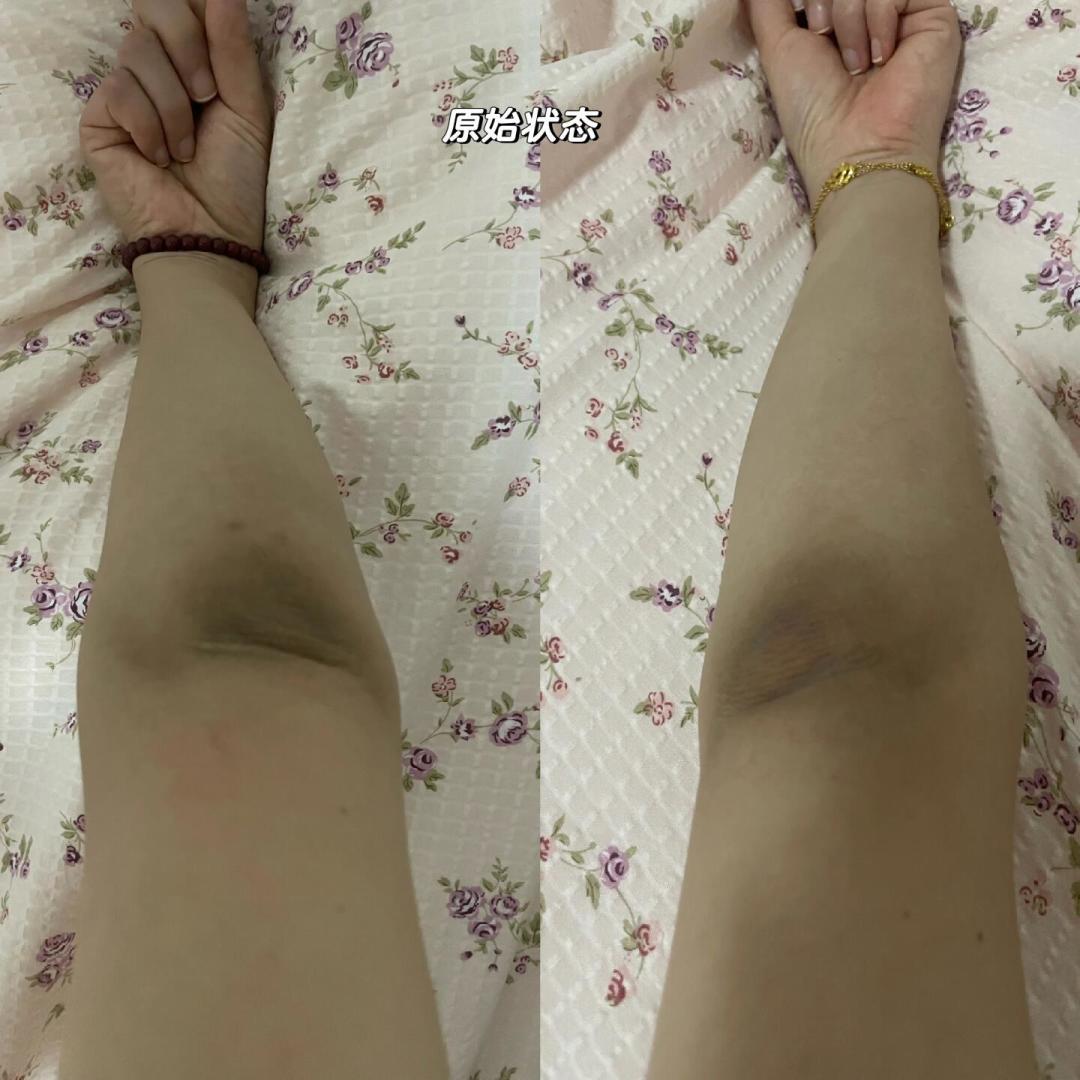 手肘膝盖黑被说不爱洗澡?真不是没搓干净:先对4项自测分清黑的类型,再看这份0到100元花钱路线