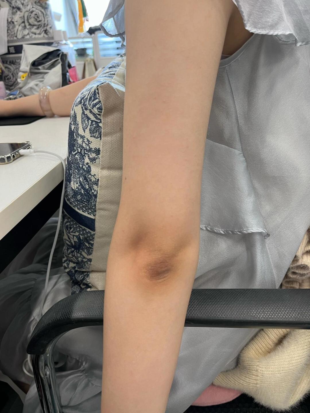 手肘膝盖黑被说不爱洗澡?真不是没搓干净:先对4项自测分清黑的类型,再看这份0到100元花钱路线