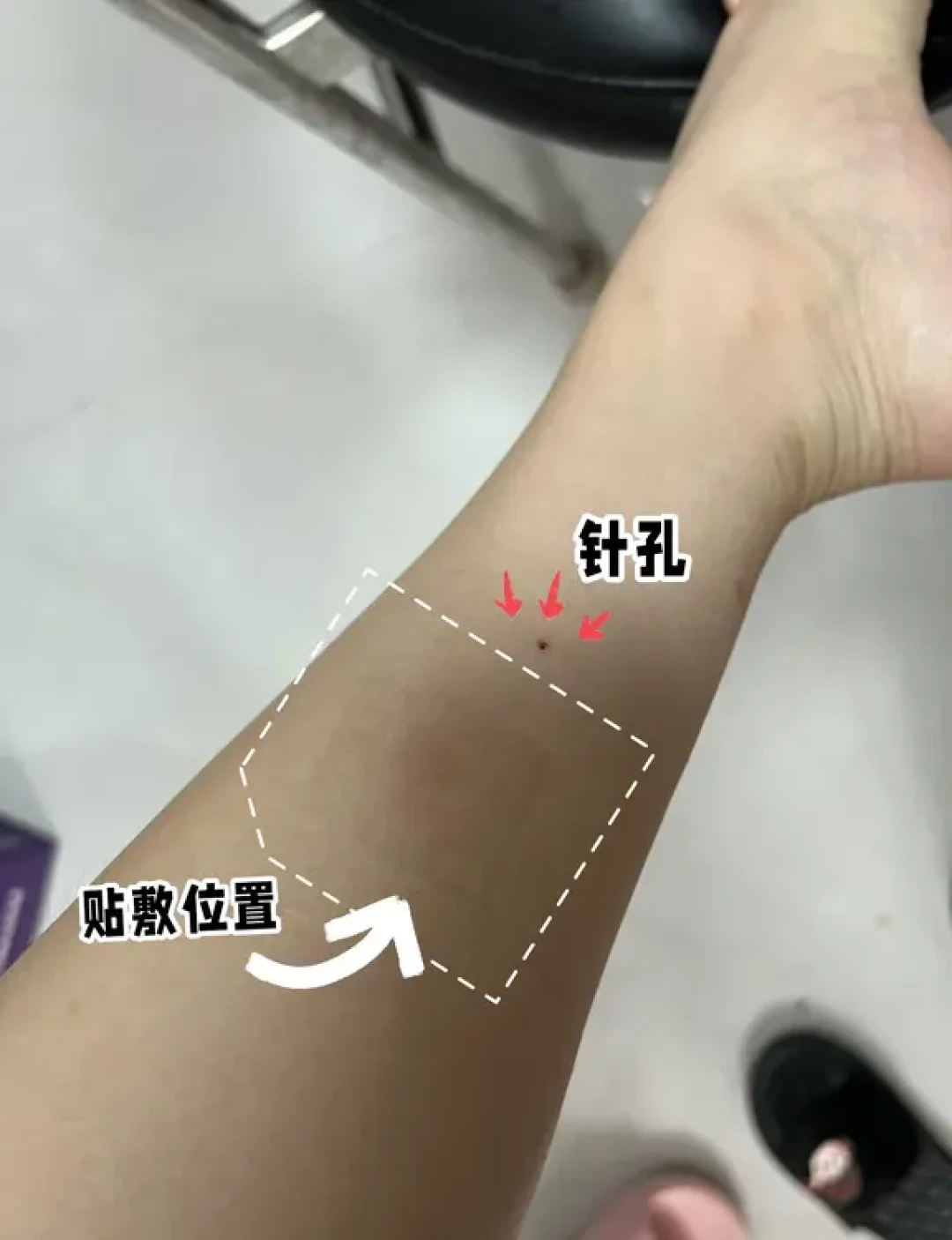 末伏贴明天截止:是智商税还是冬病夏治?赶贴之前先看完这篇