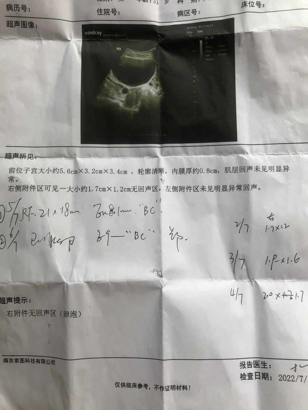 从1元试纸到医院B超：备孕排卵监测的完整决策链，大多数人花钱花错了顺序
