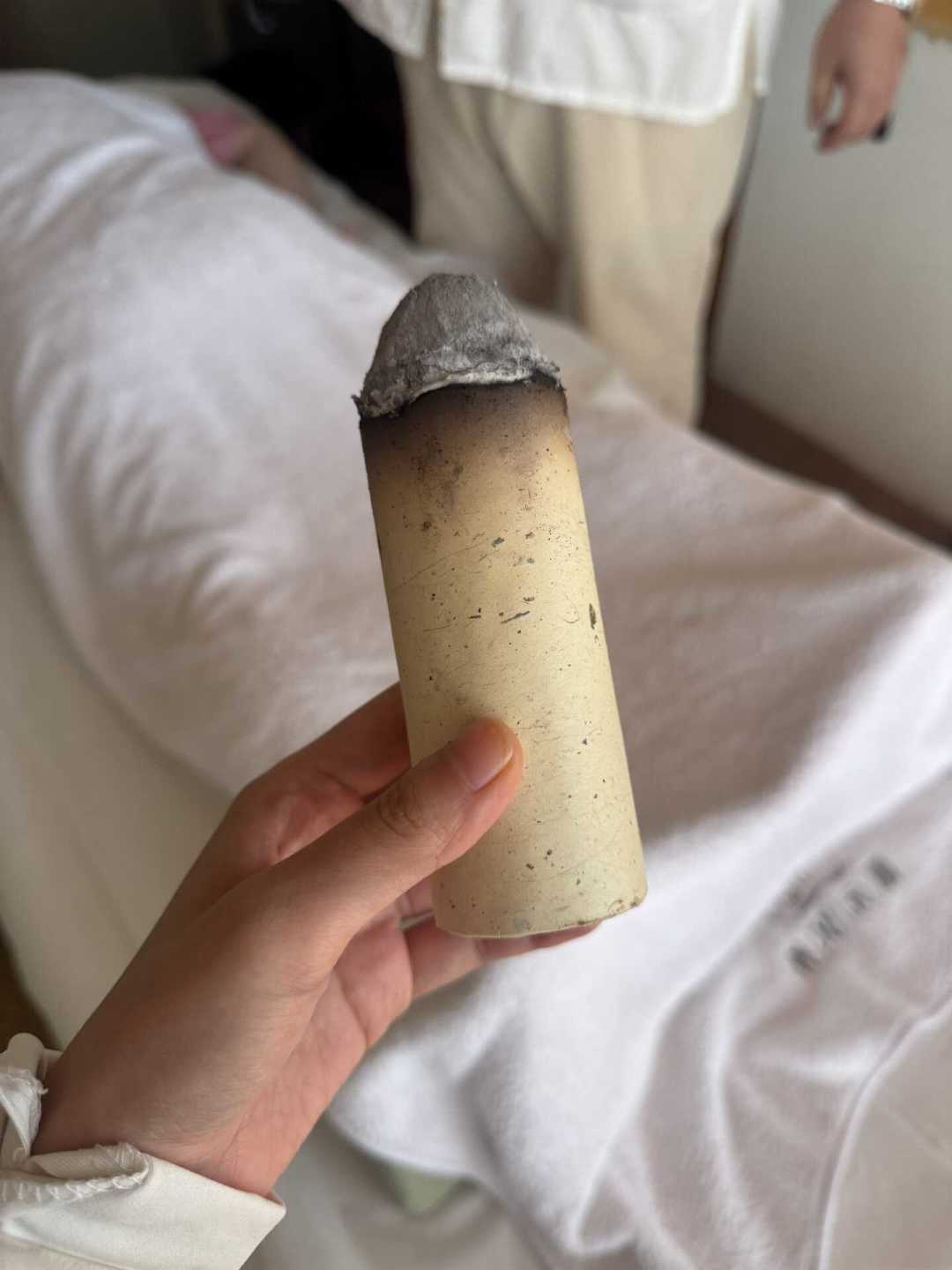 三伏明天收官：最后一把灸可以赶，但