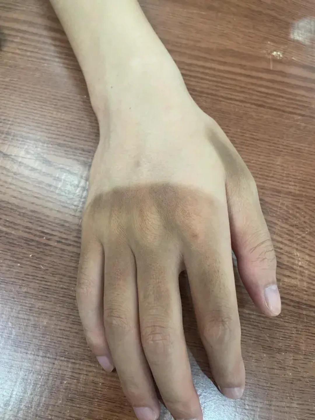 晒黑后想“白回来”先别急着下单:黄黑皮的美白上限、成分选择和避坑清单