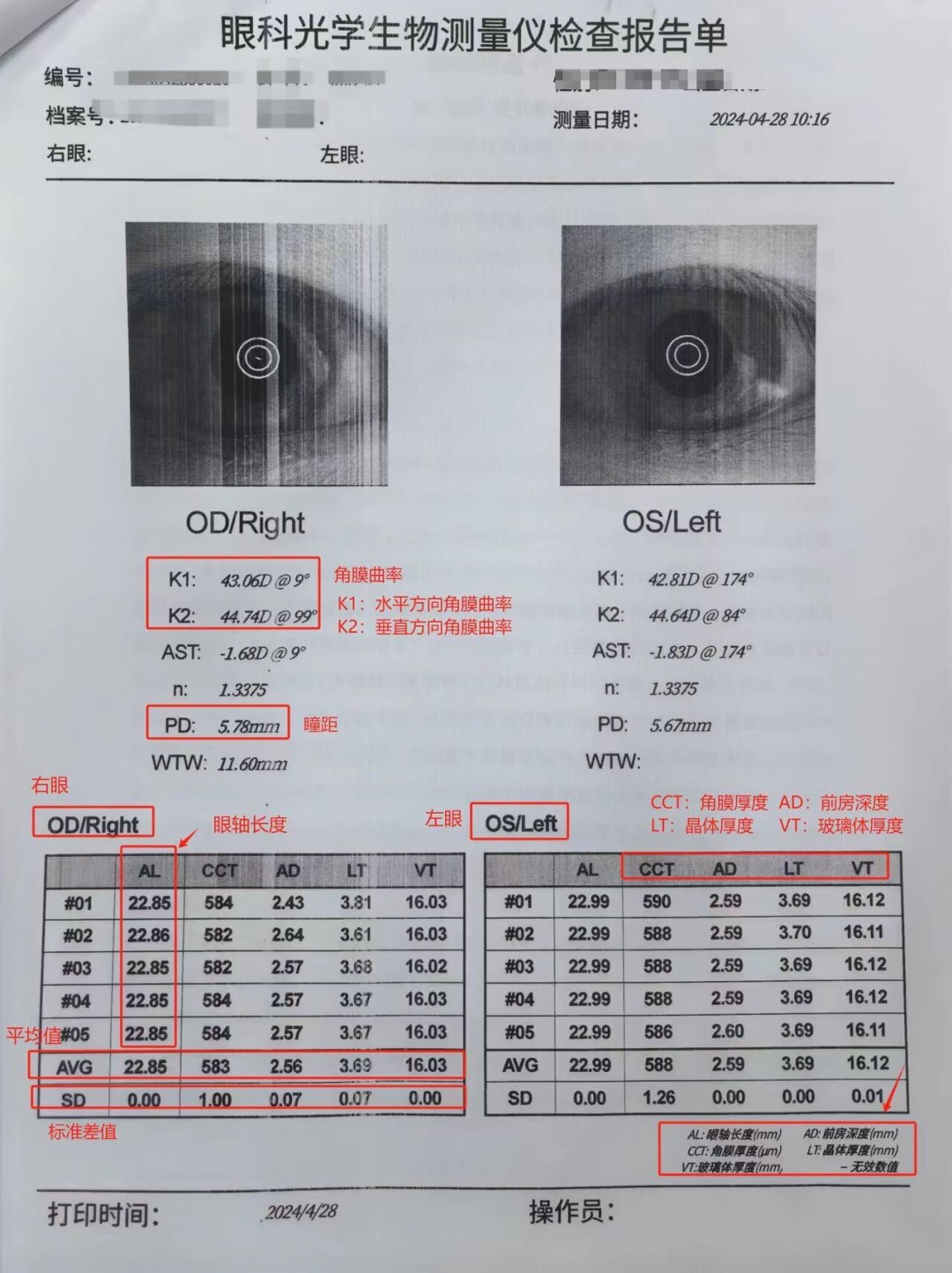暑假最后KPI是带娃查视力：阿托品300元，离焦镜4000元，OK镜上万——近视防控四档钱，哪笔才值得花？