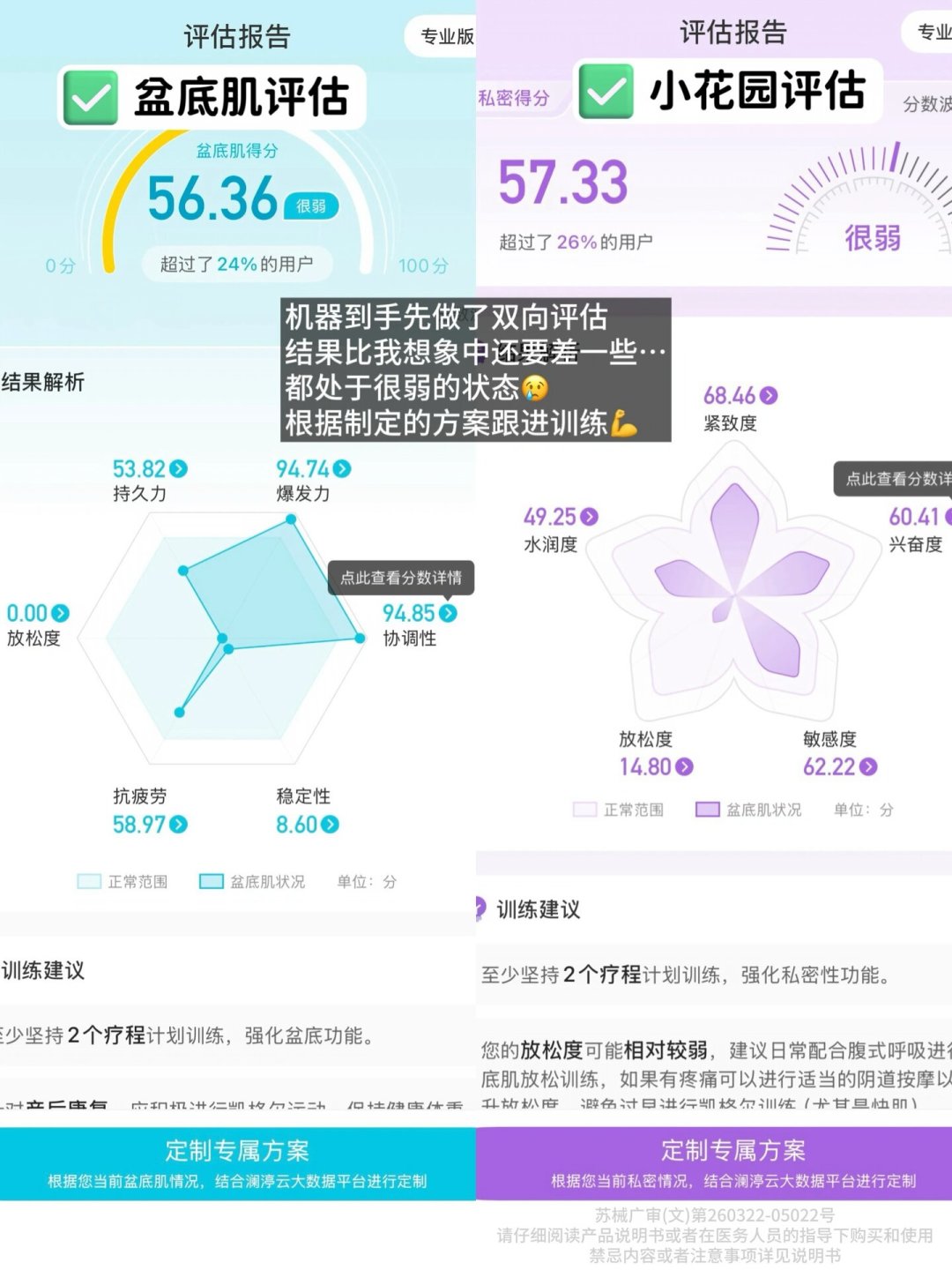 凯格尔训练仪的标杆品牌被收购了:家用盆底肌修复仪还值得买吗
