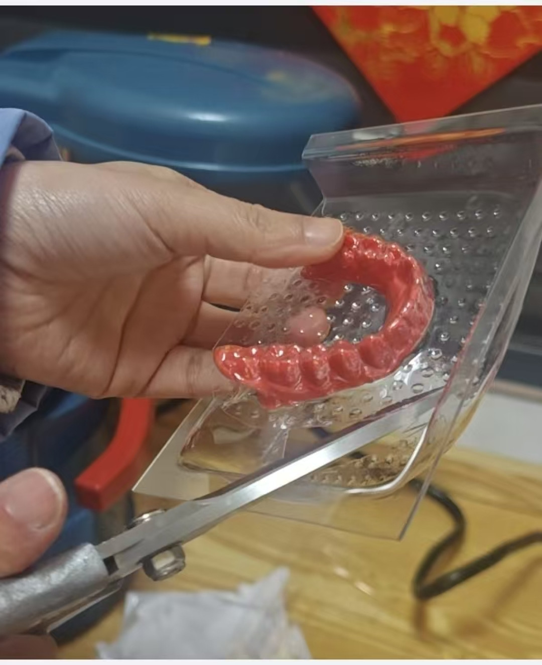 有人整牙变小脸，有人整牙脸变凹：对照正畸医生的解释和几百条恢复记录，我把“牙套脸”的真相和高风险脸型的自查清单理清了