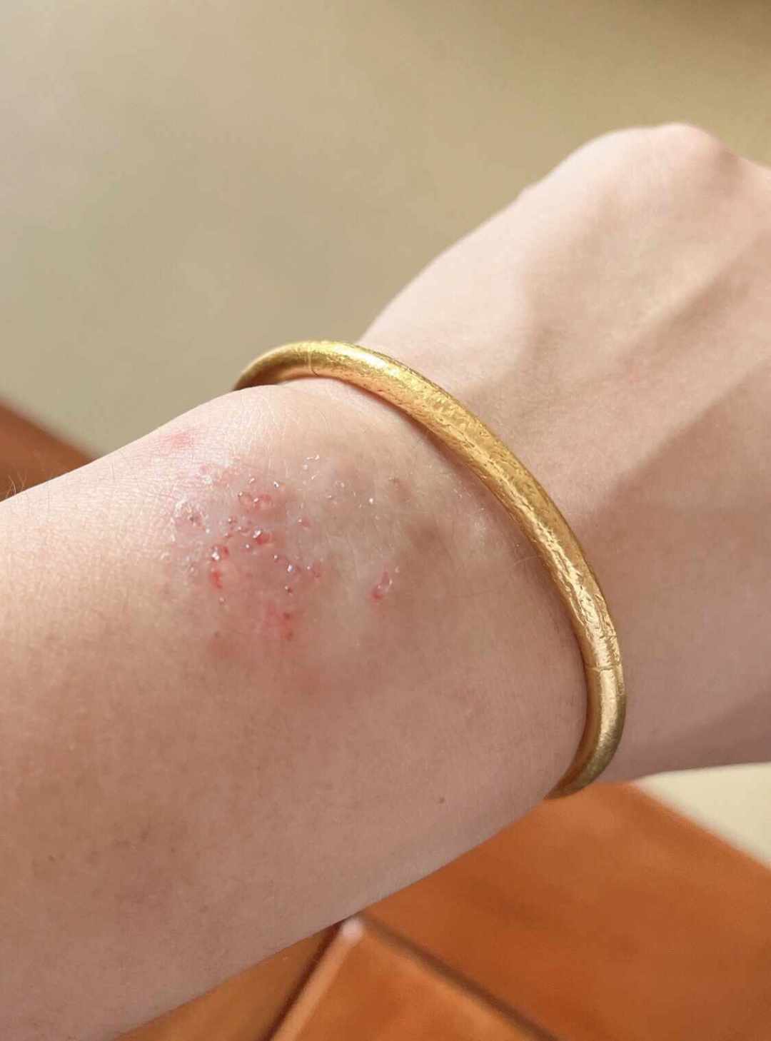 戴 Apple Watch 手腕痒？别急着换表带：对完 20 多条全网过敏吐槽，原因基本就 3 种