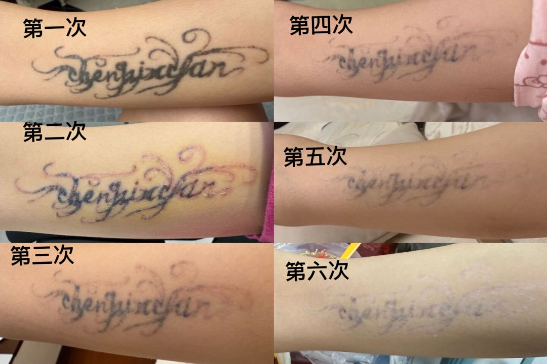 别急着把真纹身安排上:先花9.9元