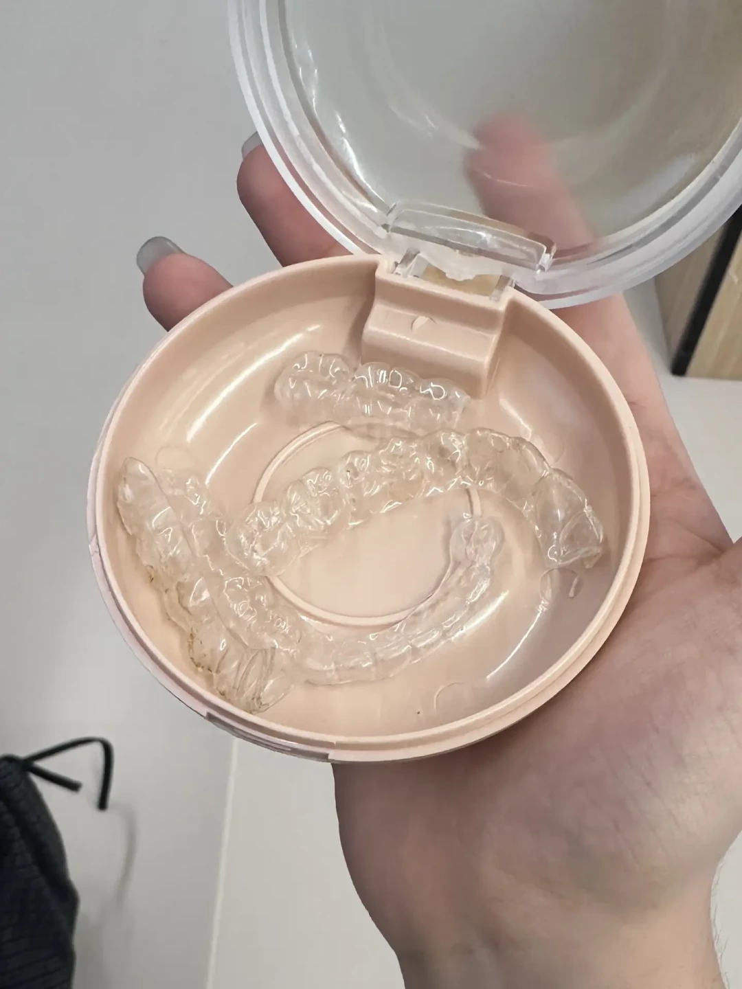 几十块的泡腾片,泡断了800块的保持器:吵了俩月的牙套清洗争议,今天说清楚