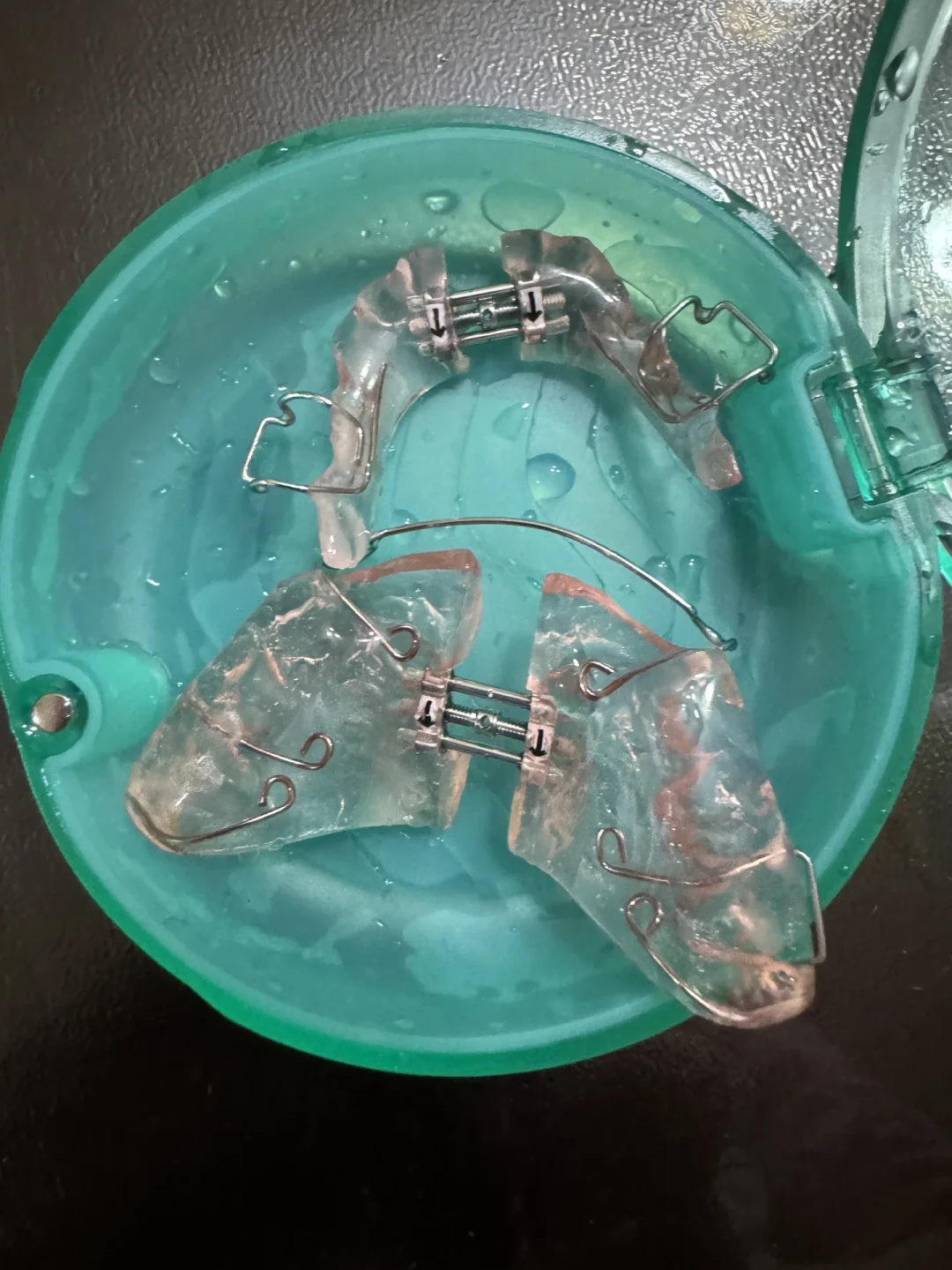 公立说等到12岁,私立说现在就要干预:对照协和医生的标准、新华社的自测指南和十几份真实账单,哪些孩子真等不起、哪些能安心等