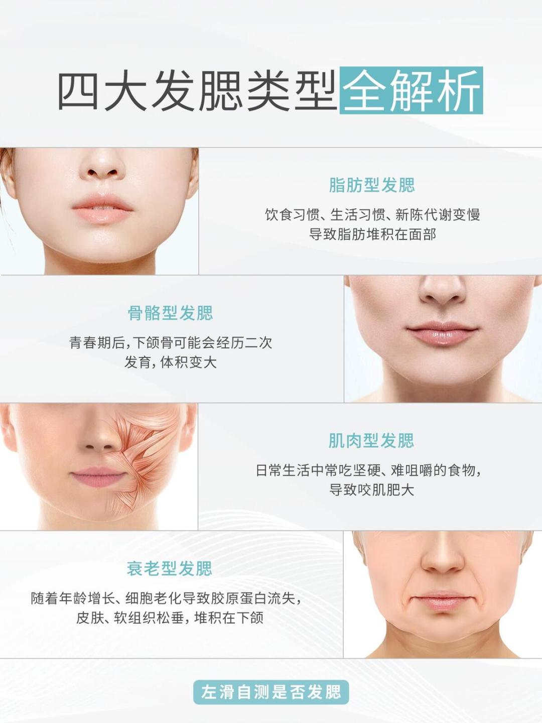 瘦了10斤脸却没小?先别急着打瘦脸针:发腮分4种,针只对其中1种有用
