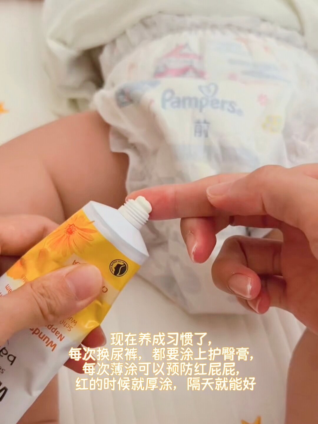 厚涂维蕾德也压不住红屁屁？先分清4种红屁屁，再说换哪支膏、什么时候去医院
