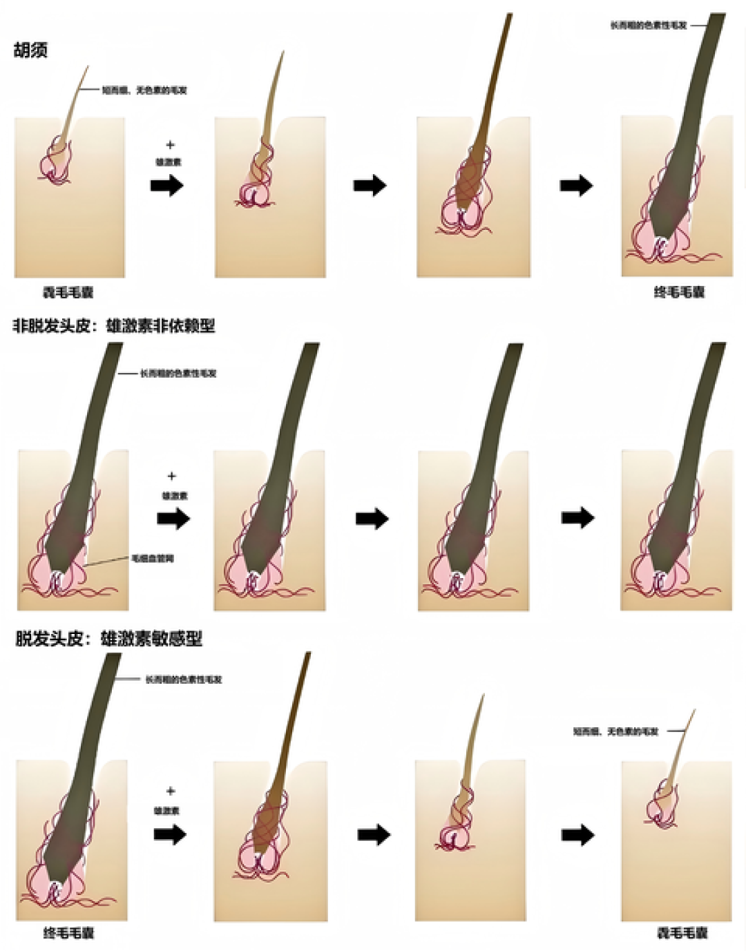 「贝克汉姆秃顶」2.3亿阅读:他本人澄清理发器翻车,但普通人防脱下单前先看这份账单