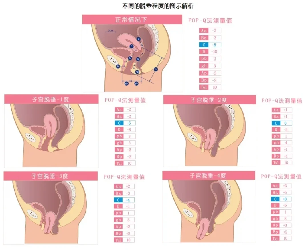 被诊断