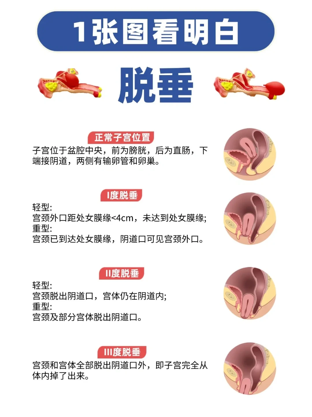 被诊断