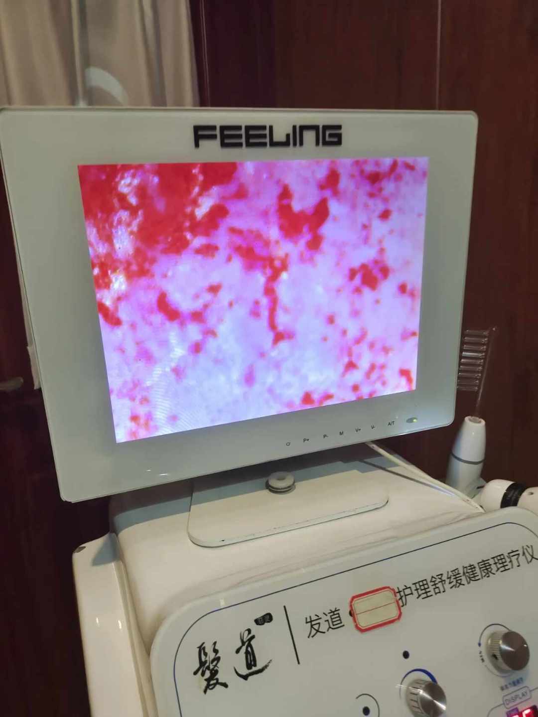 洗个头被说“头皮有虫卵”?警方已查实:虫卵是伪造的,按诈骗罪抓了人。翻完多地曝光,我把这4步剧本和止损清单拆给你看