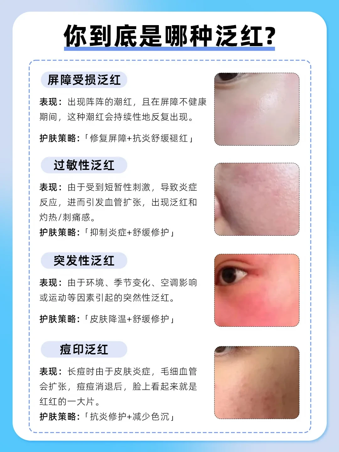 脸越洗越红？翻了小红书和知乎的50多篇帖子：5个止损动作全是免费的