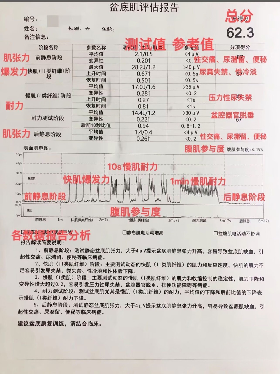 拿到盆底肌评估报告别急着练凯格尔:约20%-30%的产后问题是“紧”不是“松”