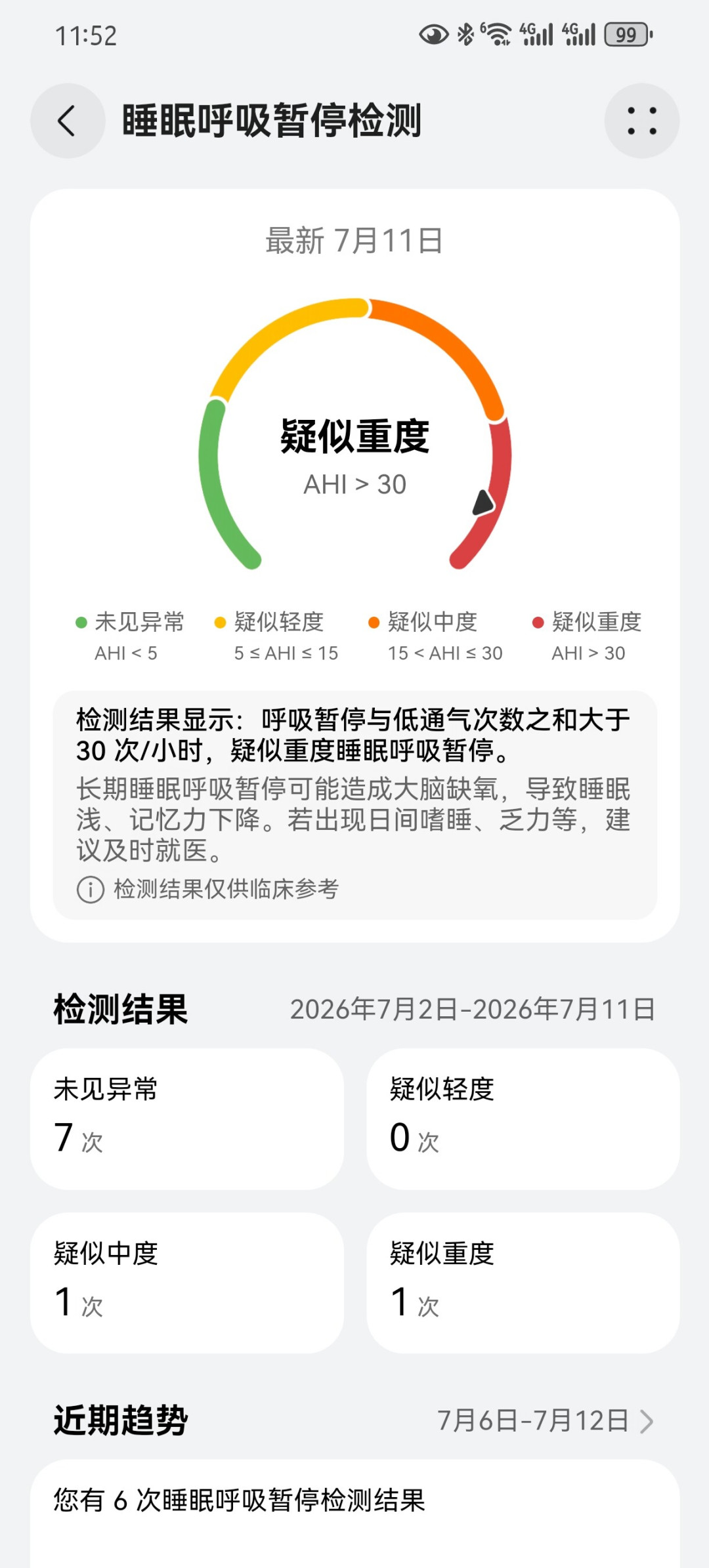 没戴表也记你