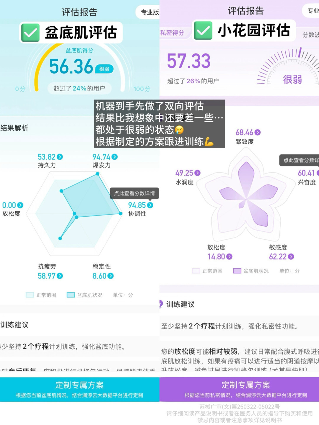 盆底肌修复仪“租机热”：筛完20多条打卡帖，算清去医院、租、买三本账