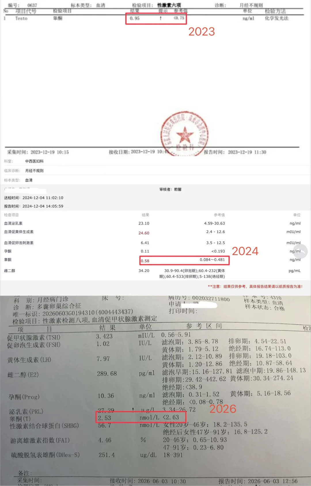 “多囊卵巢”用了90年终于改名：看病先挂妇科还是内分泌科？这笔检查花费账，去医院前先算清