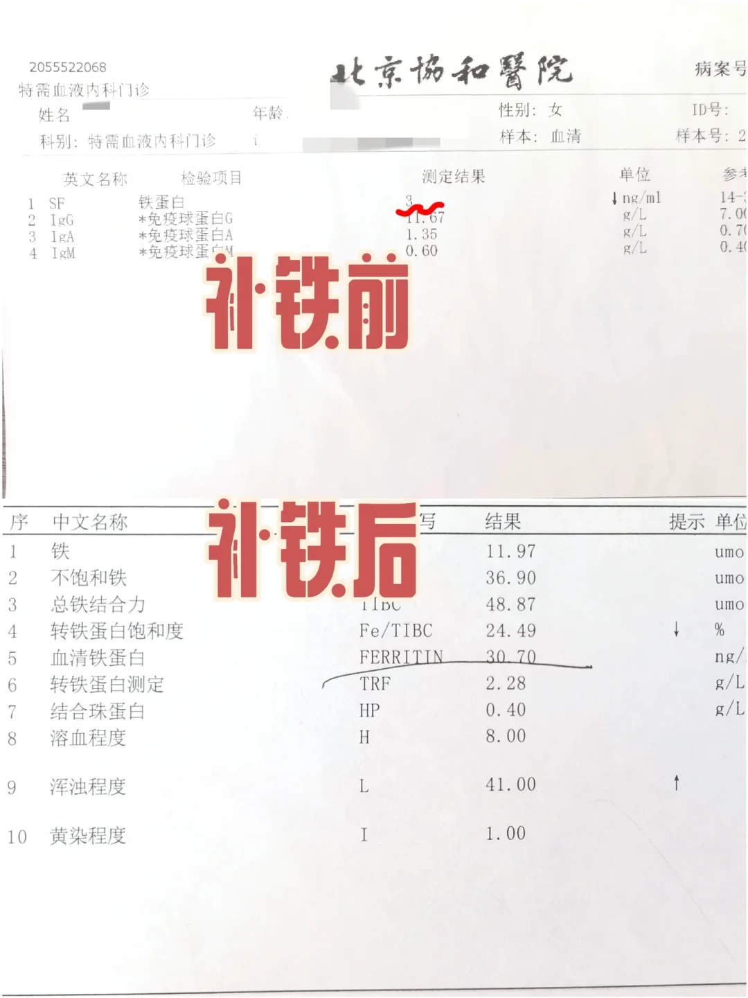 布莱恩·约翰逊确诊“绝症”上热搜?对完信源:最吓人的不是病,是他拖了11年的那个数字
