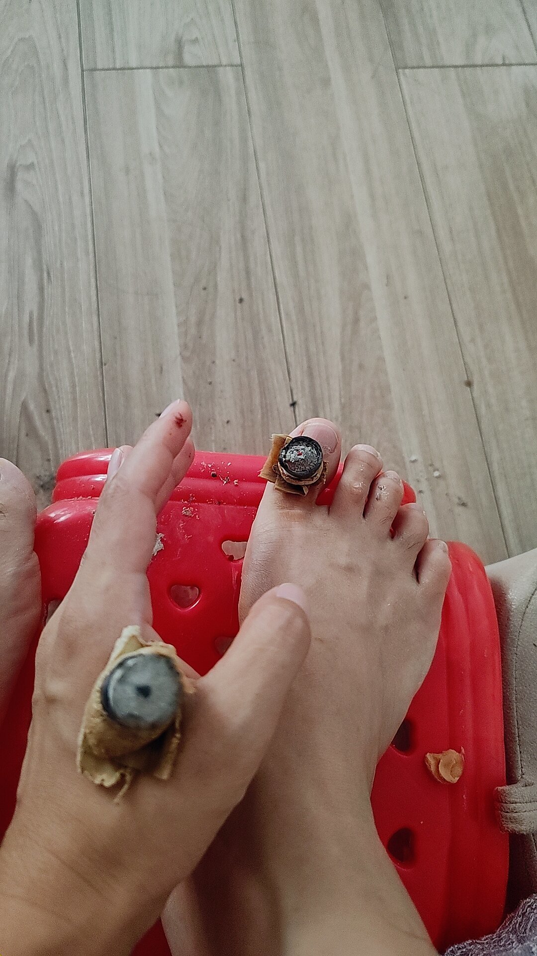 刚出伏就被催做“入秋第一灸”:接着灸还是停一停,下单前先看这份自查清单