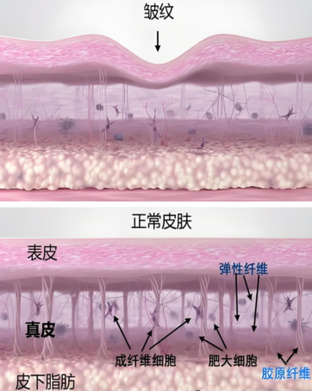 微晶瓷=瑞德喜=芮得怡:2025年才在国内拿到证,第一次打前必须验这三件事