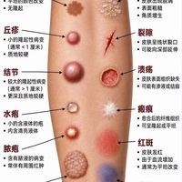 🔥 皮肤问题对号入座！一张图全看懂！🚨