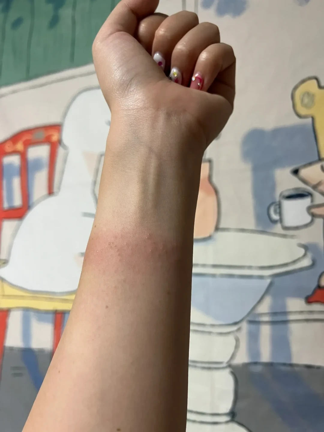 戴串手痒不是“认主”是过敏:出汗季收尾前,先看清你的木串在“漏”什么