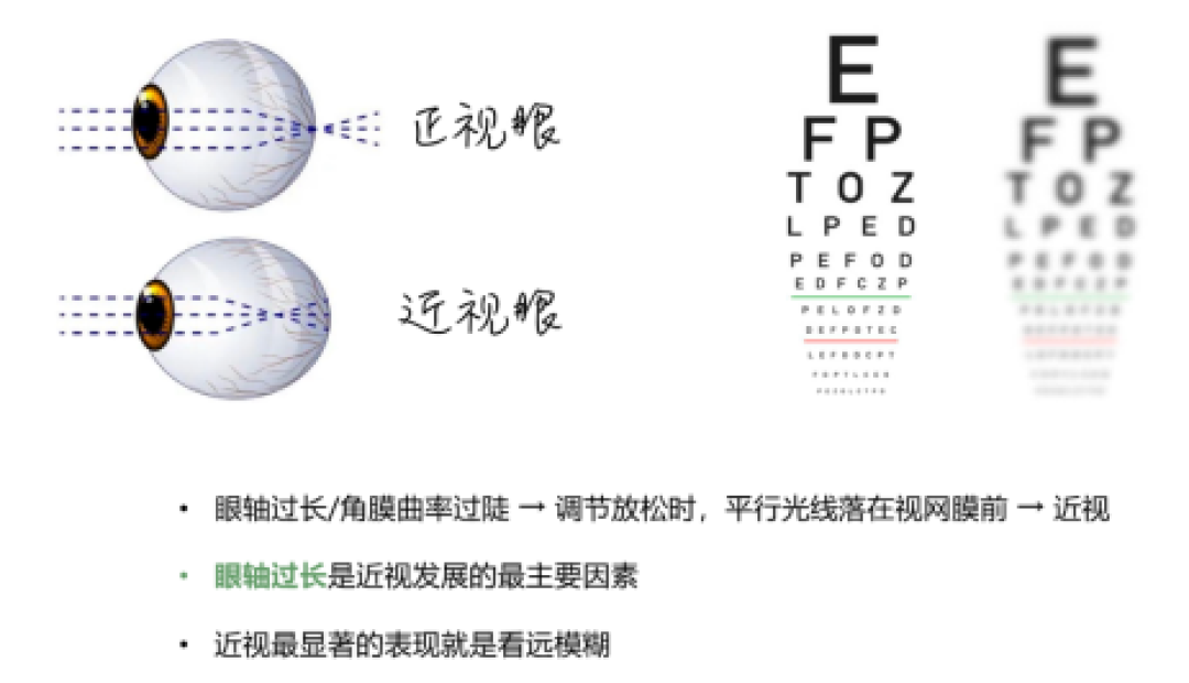 近视防控清单花了三万，医生说一半白花：还有两天开学，带娃复查前先看清钱该花在哪