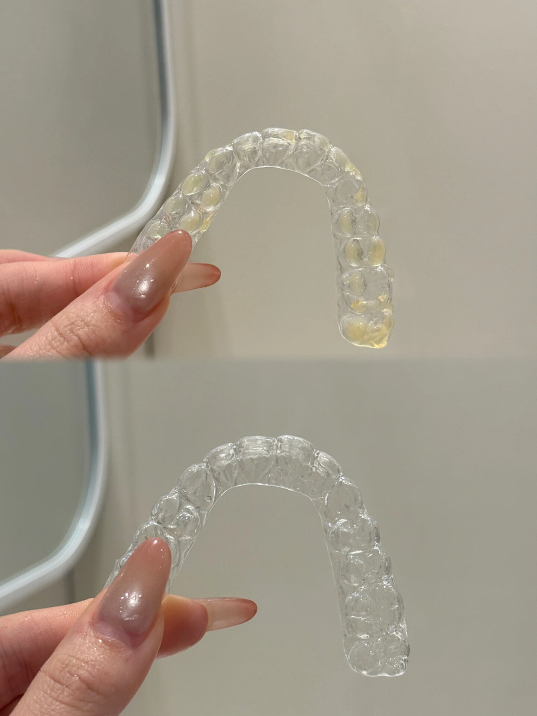 摘牙套不是终点,是另一段消费的开始:保持器的隐性成本与避坑清单