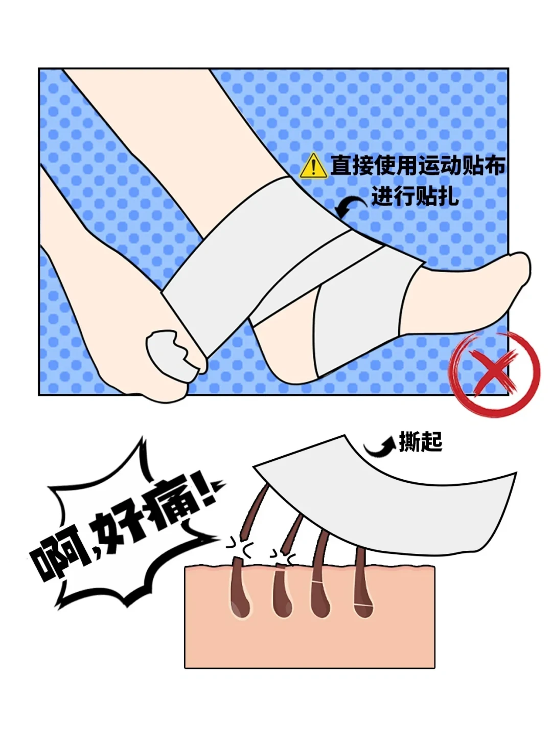 篮球护踝塞不进足球鞋、打脚看视频学不会：翻完这一年几十条贴扎教学和护踝实购帖，野球场的脚踝防护按履历分四档