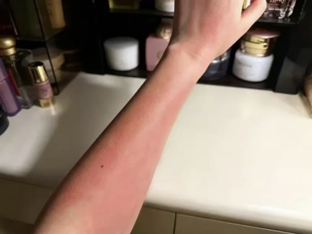军训晒黑了,先别急着敷美白面膜?看完晒后72小时的行动顺序再花钱