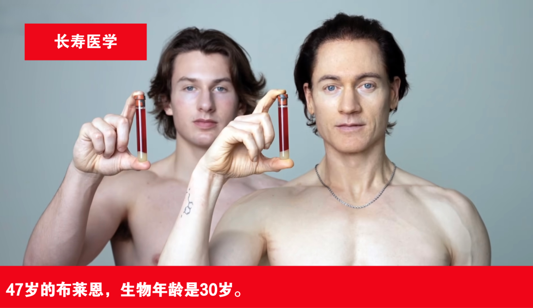 布莱恩·约翰逊的病不是换血换来的:27年两道自身免疫诊断书,桥本人群该抄的是一份复查清单