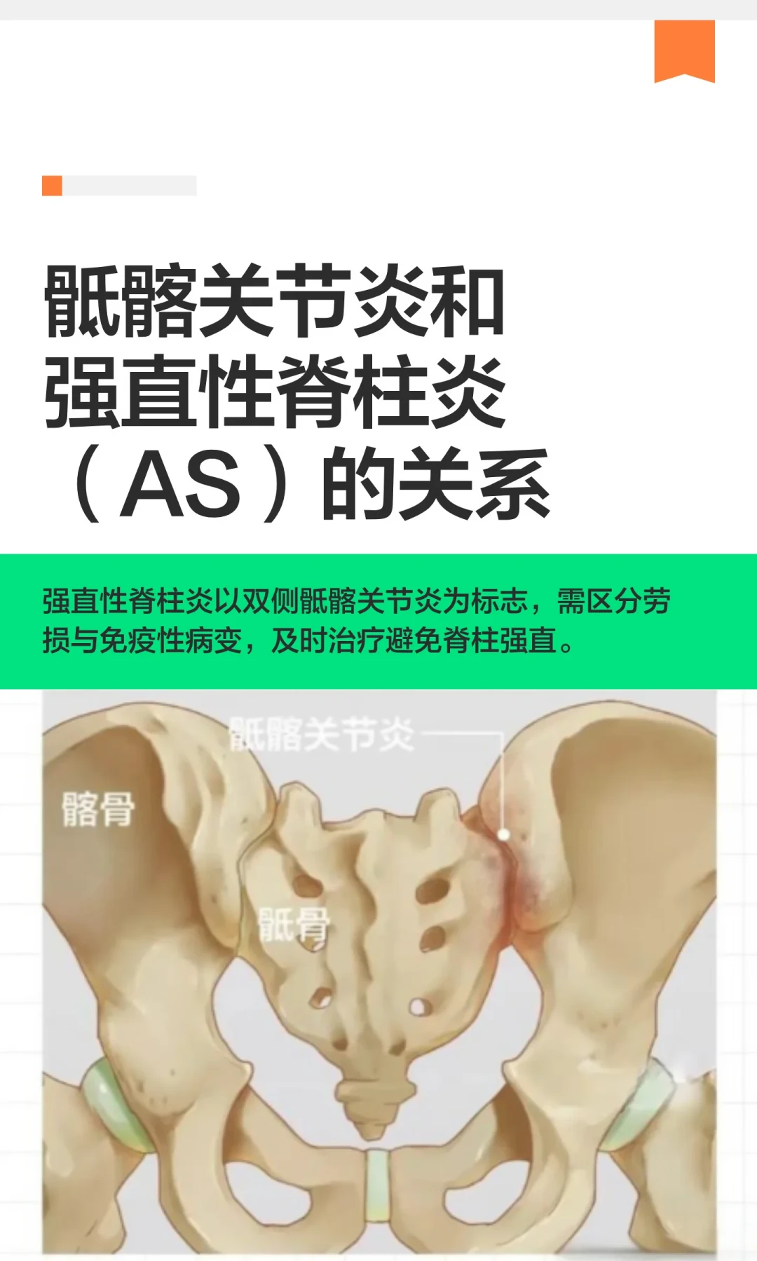 蔡少芬的强直