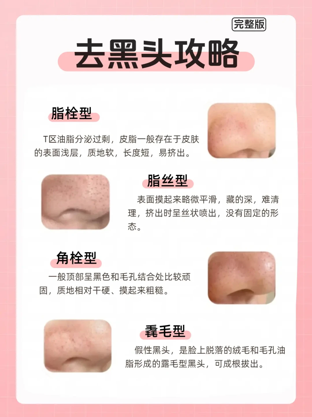婴儿油+牙线
