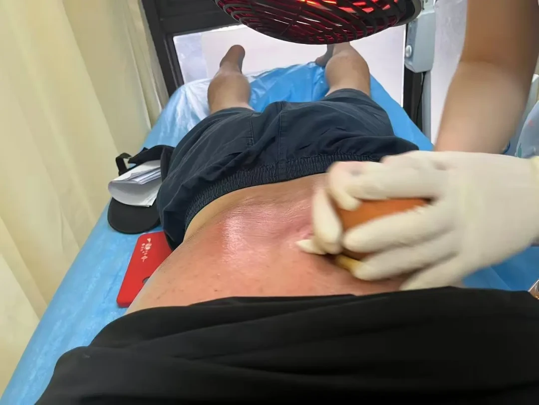 出伏第一波喷嚏,不等于冬病夏治白做了:先分清花粉、冷空气和感冒,再用4项记录给这个夏天打分