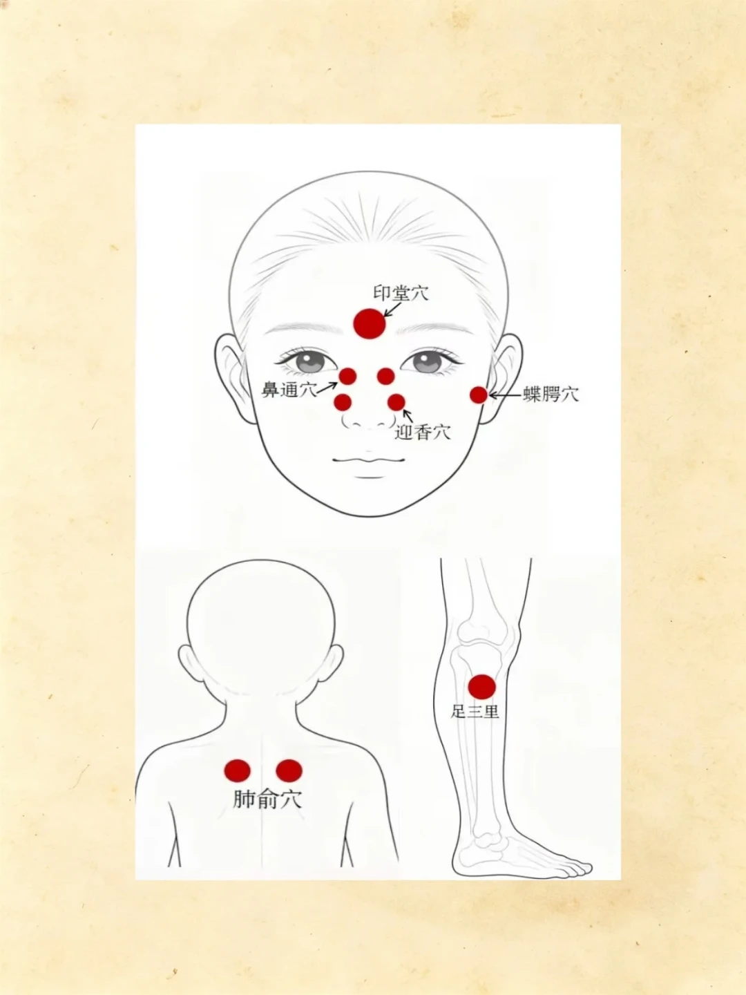 出伏第一波喷嚏,不等于冬病夏治白做了:先分清花粉、冷空气和感冒,再用4项记录给这个夏天打分
