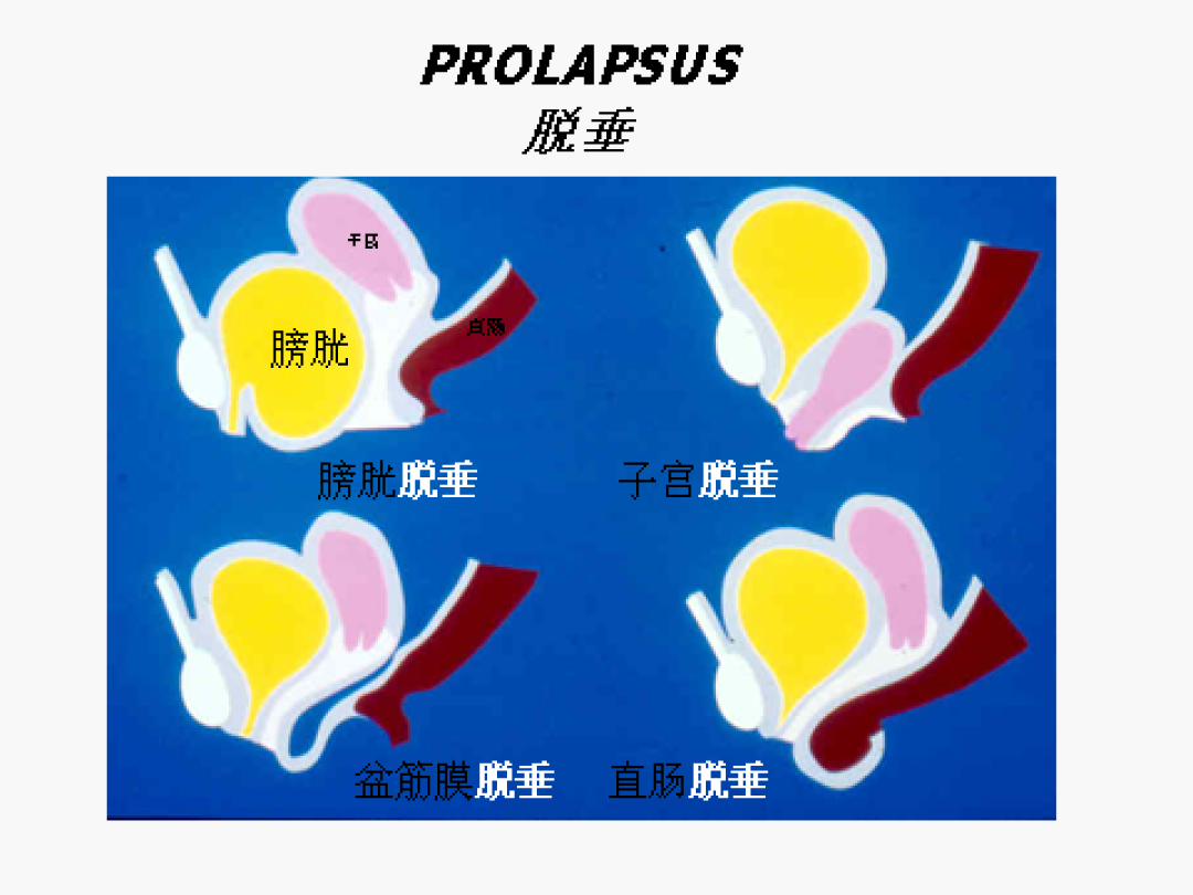 产后42天查出