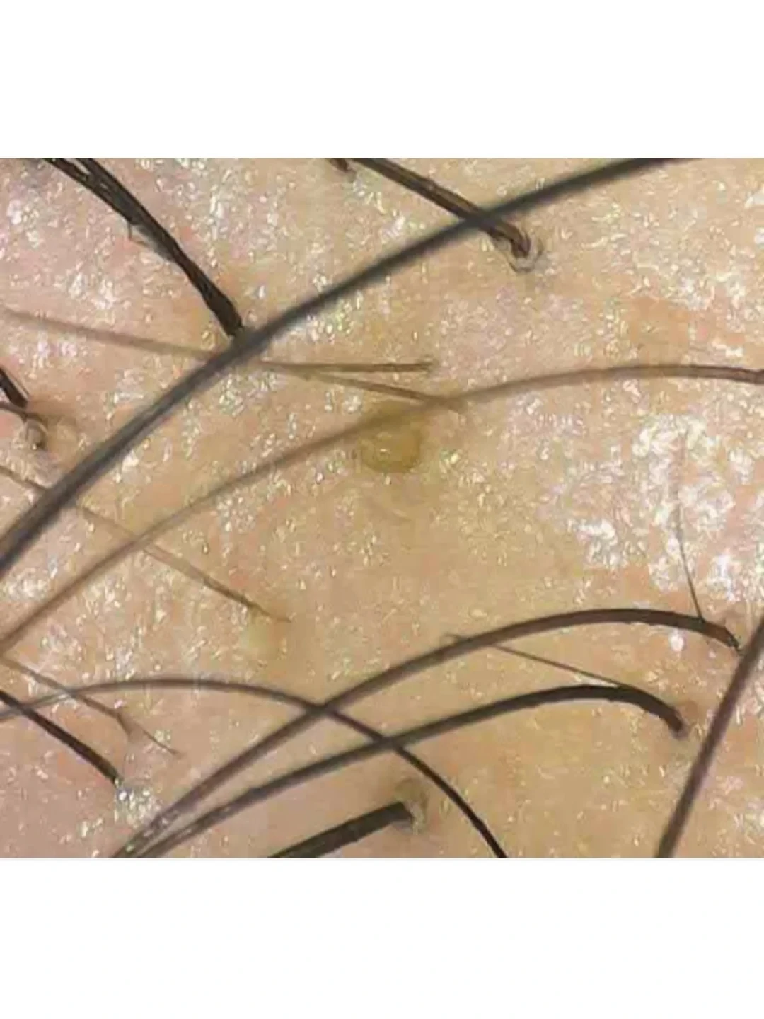 男生医美广告打进公交站:30+男士第一次躺下前,先把“毛发、皮肤、骨相”三本账算清