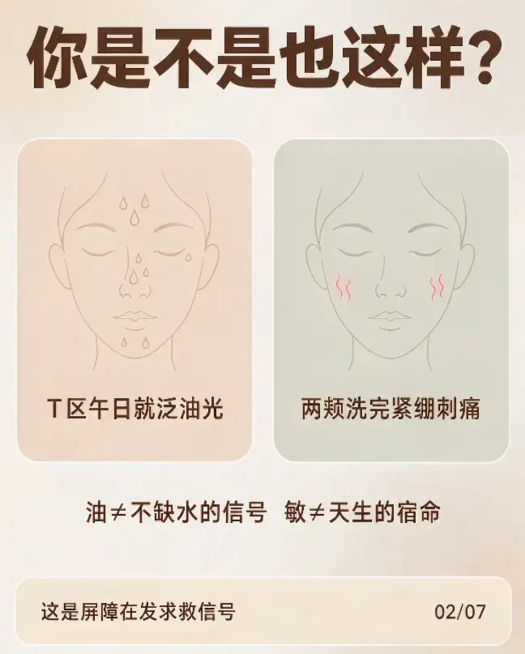 九月的“外油内干”帖又刷屏:对完8294赞“这是脂皮”反贴、评论区互掐的自救法和三条过度水合警告,先别急着买补水或控油的,花30秒看清你的“干”是哪种